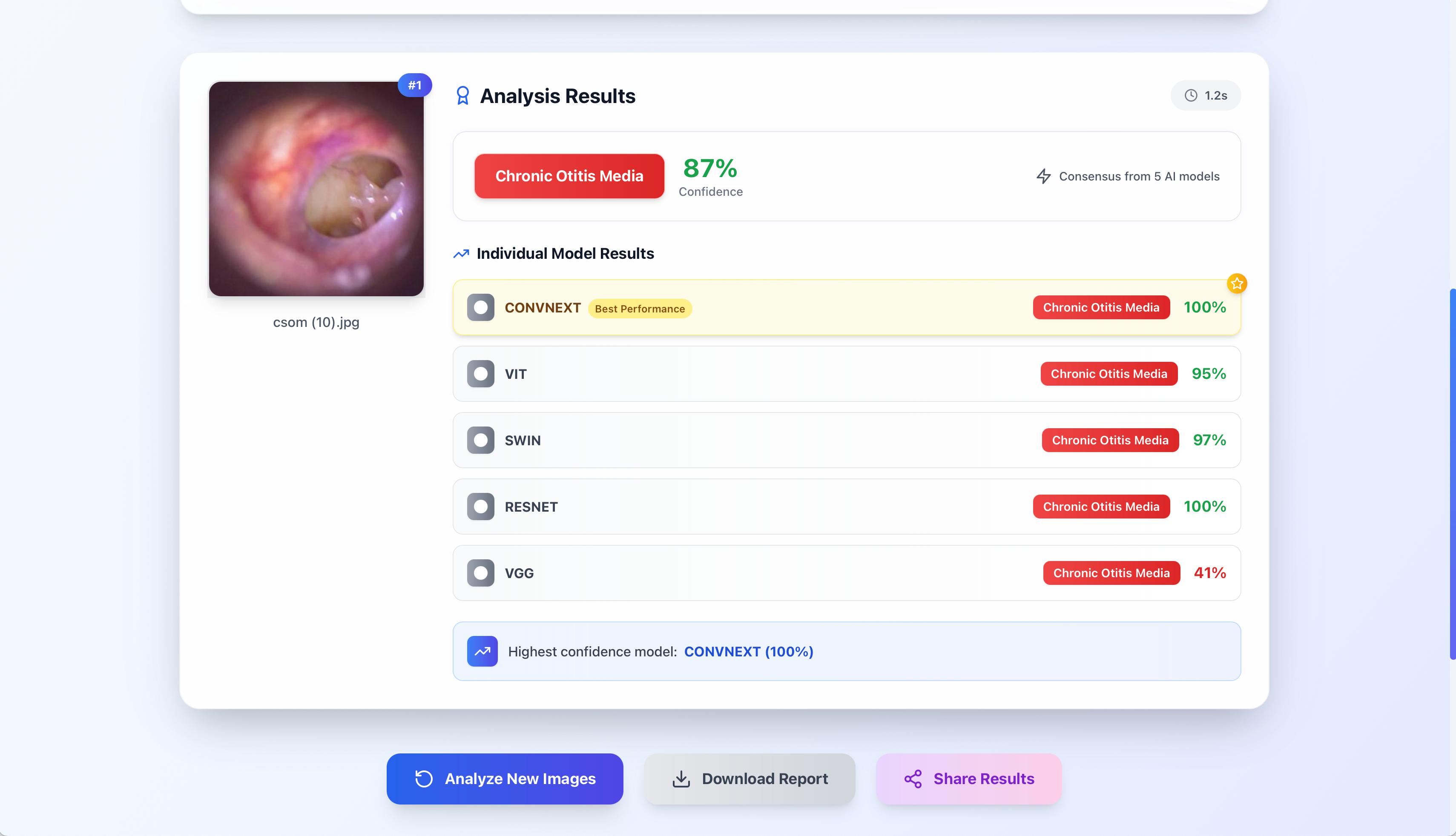 AI-Powered Otitis Media Diagnosis Platform
